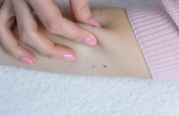 How many sessions are needed for warts removal ?