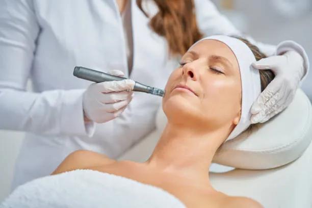 Does RF Microneedling Improve Skin Texture Fast?
