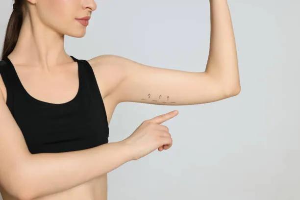 What Causes Flabby Arms and Can Arm Lift Fix Them?