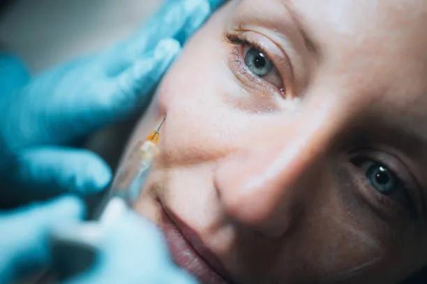 Are Cheek Fillers Suitable for All Face Shapes?
