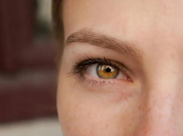 How Does Eyelid Surgery Reduce Eye Puffiness?