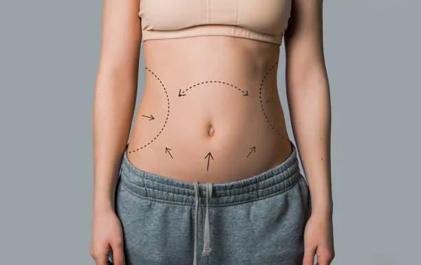 Can Tummy Tuck Be Combined With Other Procedures?