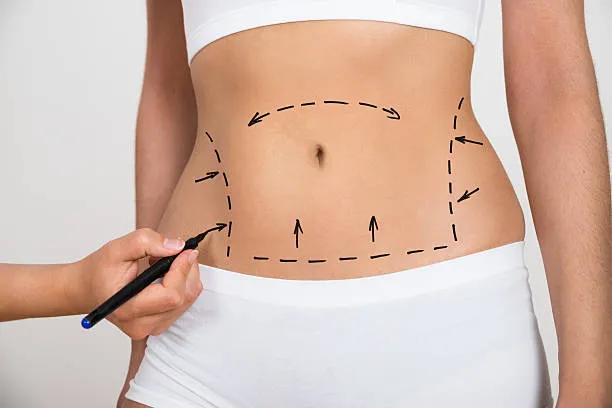 Can Tummy Tuck Restore a Firmer Abdominal Profile?