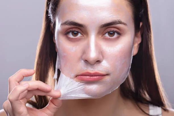 Does Chemical Peel Improve Skin Clarity?