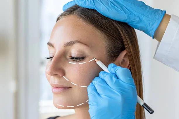 Can Facelifts Improve Facial Balance and Harmony?