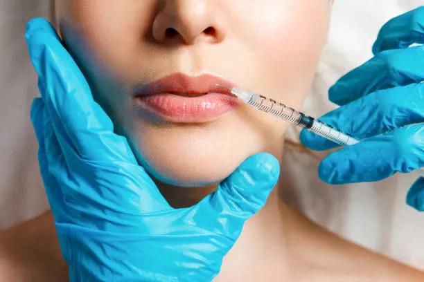 Can Lip Fillers Improve Lip Hydration?