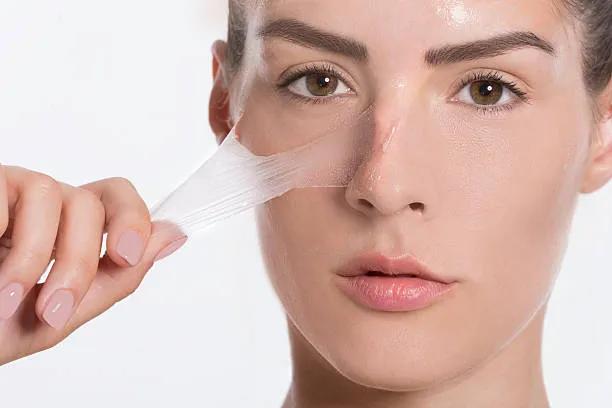 Can Chemical Peels Reduce Blackheads?