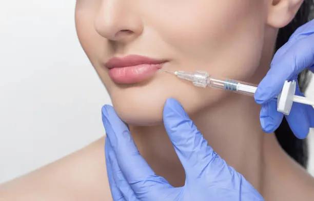 How Do Russian Lip Fillers Improve Profiles?
