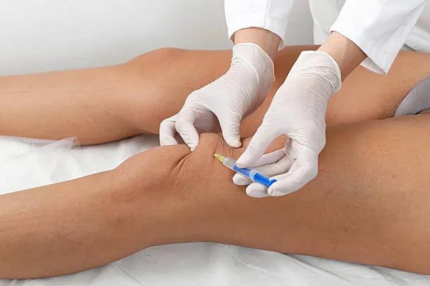Can PRP injections for knees fix joint pain?