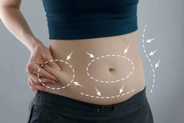 Can Liposuction Help With Body Contouring?