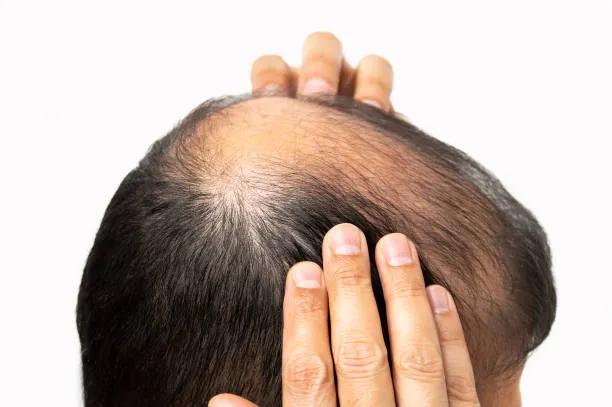 Does GFC Treatment for Hair Strengthen Roots?