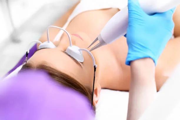 Can Pico Laser Treatment Fade Sun Damage Spots?