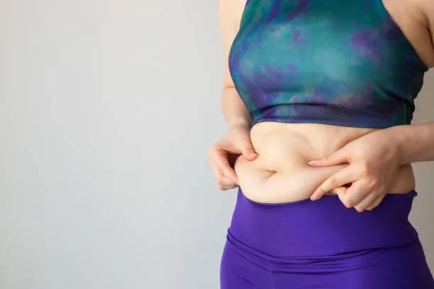 Is Tummy Tuck a Permanent Body Contouring Option?