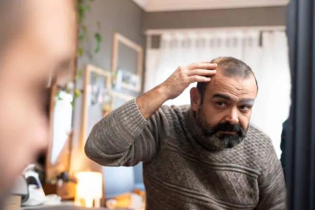 Is Hair Loss Treatment Effective for Alopecia?