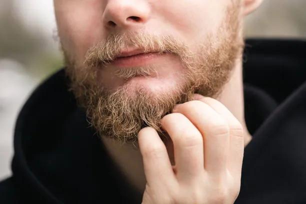 Does Beard Hair Transplant Help Boost Confidence?
