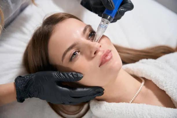 Can Dermapen Microneedling Treat Stretch Marks?