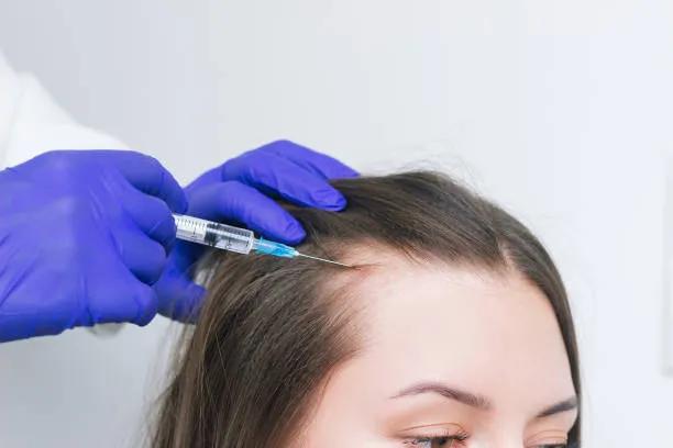 Who Is the Ideal Candidate for PRP Hair Treatment ?