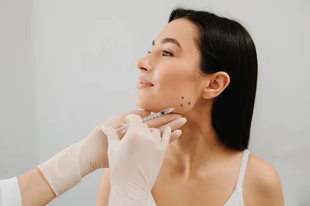 Do Jawline Filler Injections Define Your Face?