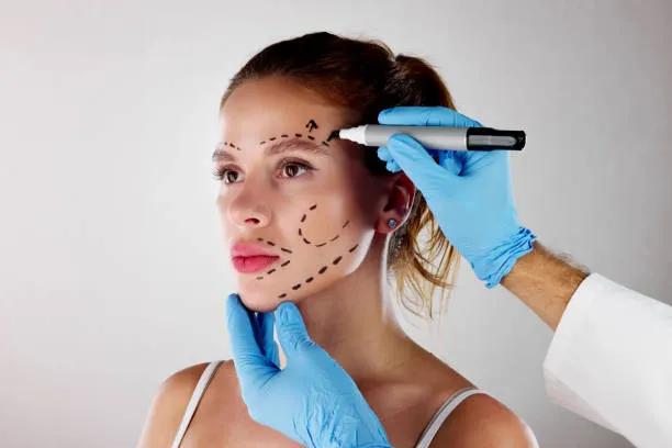 Do Facelifts Reduce Fine Lines Completely?