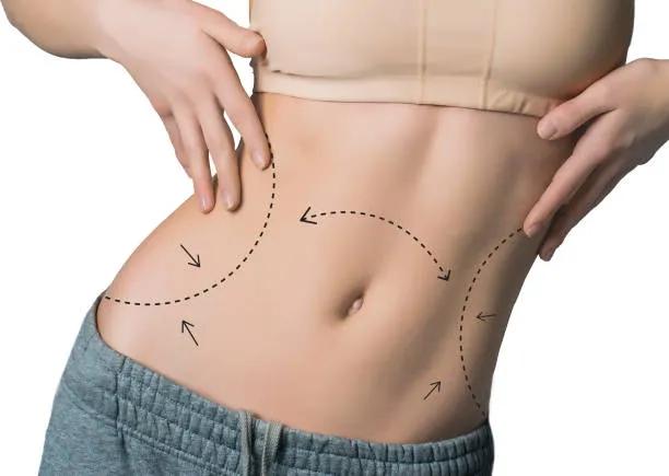 Can Tummy Tuck Improve Waistline Definition Fast?