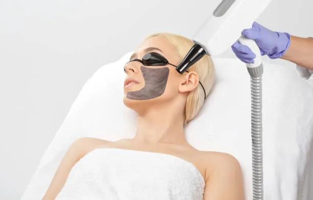 Can Laser Carbon Peel shrink visible pores?