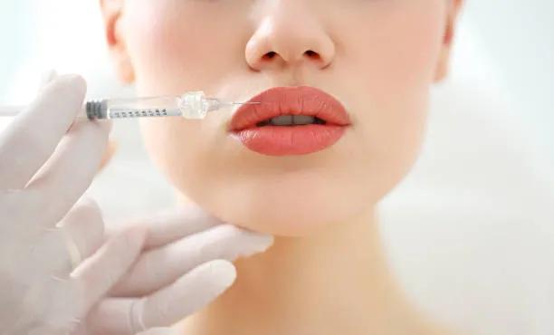 What Are the Benefits of Lip Fillers Injection Today?