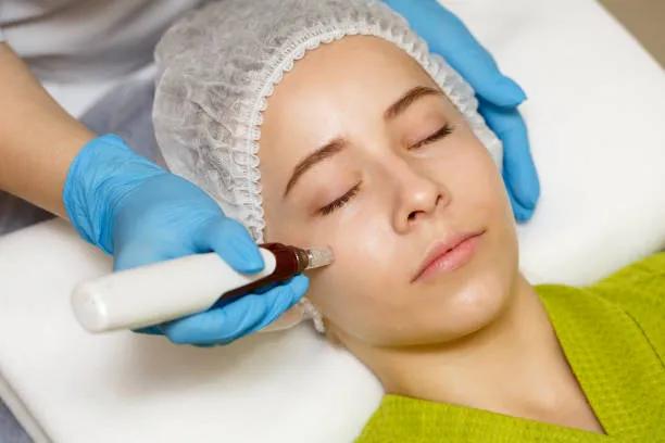 Does Microneedling Help with Sun-Damaged Skin?