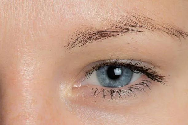 Can Eyelid Surgery Fix Tired-Looking Eyes?
