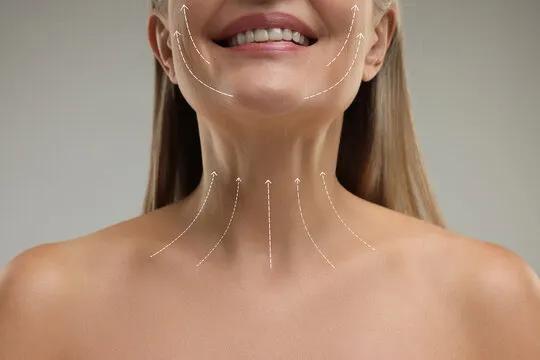 Is Neck Lift Surgery a Good Anti-Aging Choice?