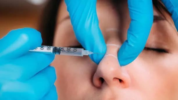 Can Botox for Nose Improve Profile Without Surgery?