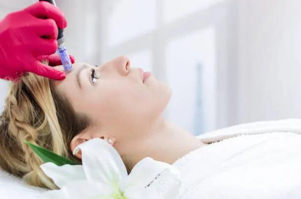 Does Microneedling Improve Rough Skin Texture?