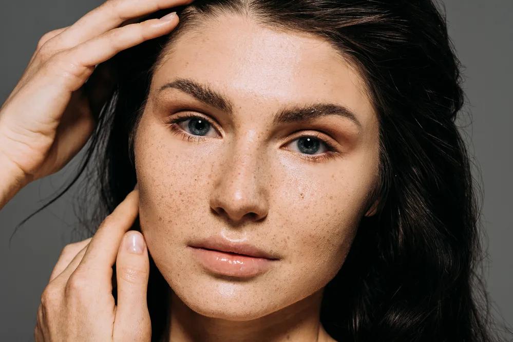 How Does Melasma Treatment Improve Clear Skin?