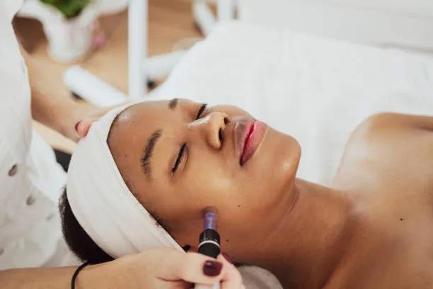 Does RF Microneedling Work for Enlarged Pores?
