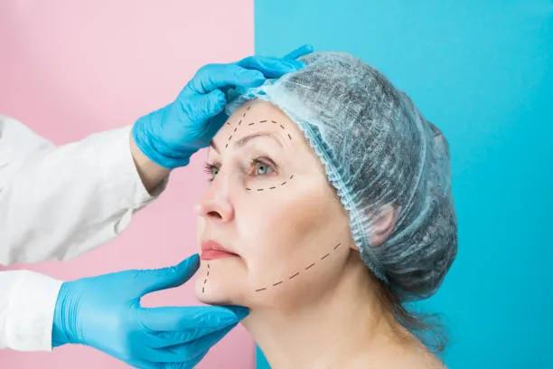 Can Facelifts Deliver Natural Looking Results?