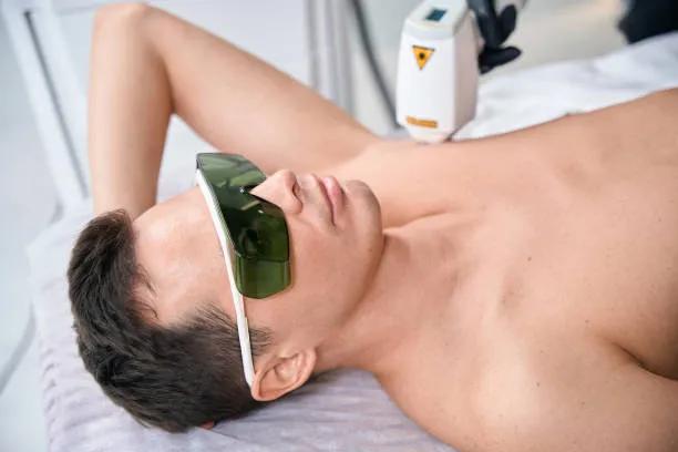 Can laser hair removal for men treat coarse hair?