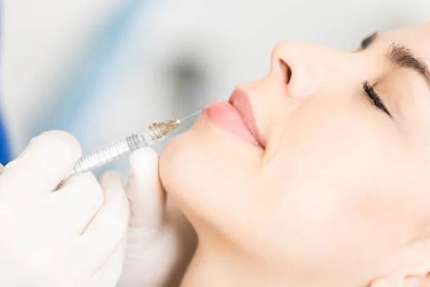 Does lip filler Help Restore Youthful Lip Shape?